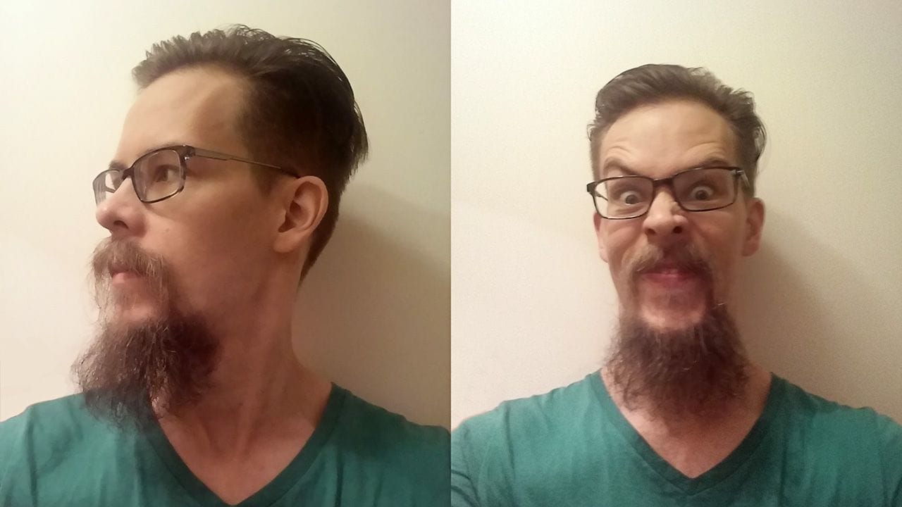 The beard growth after 46 weeks.
