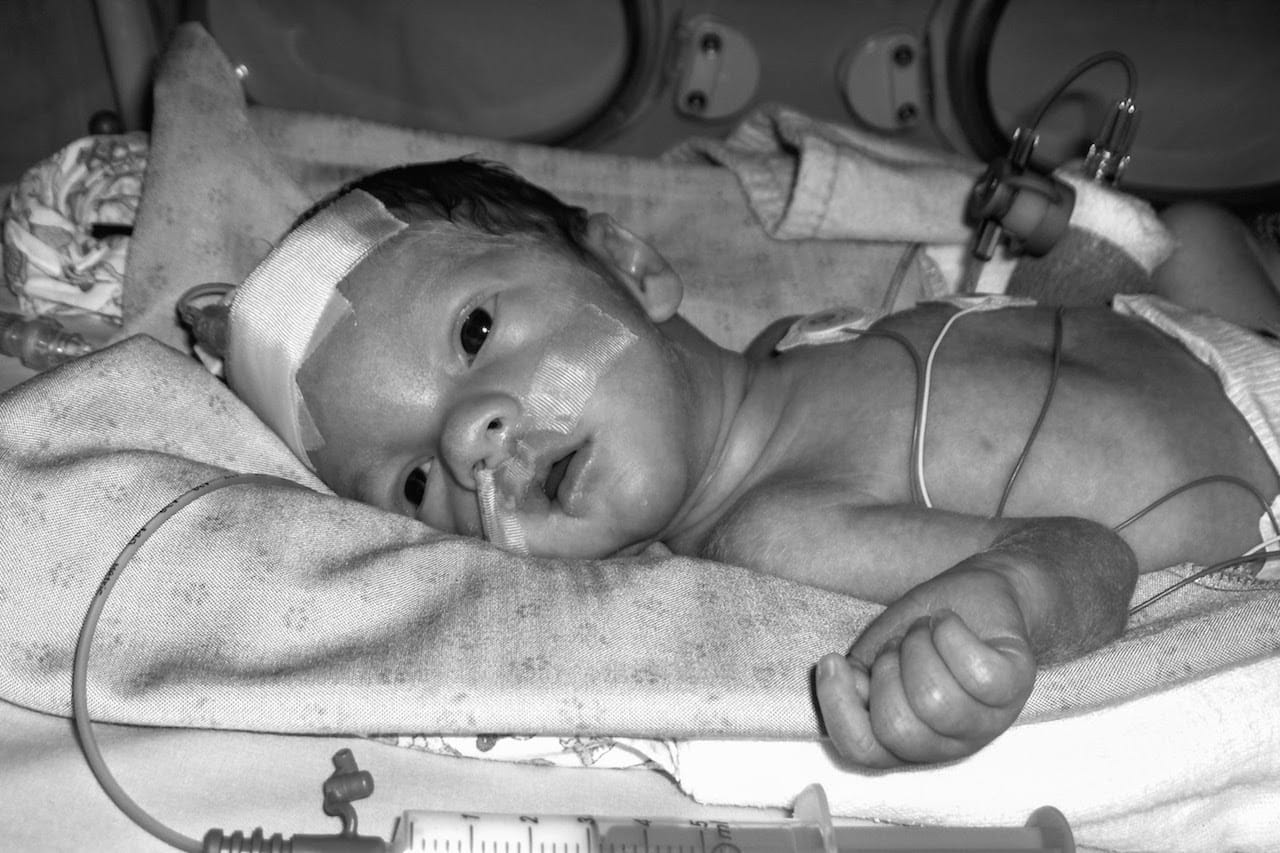 Lucien Eriksson lying in an incubator at 3 days old.
