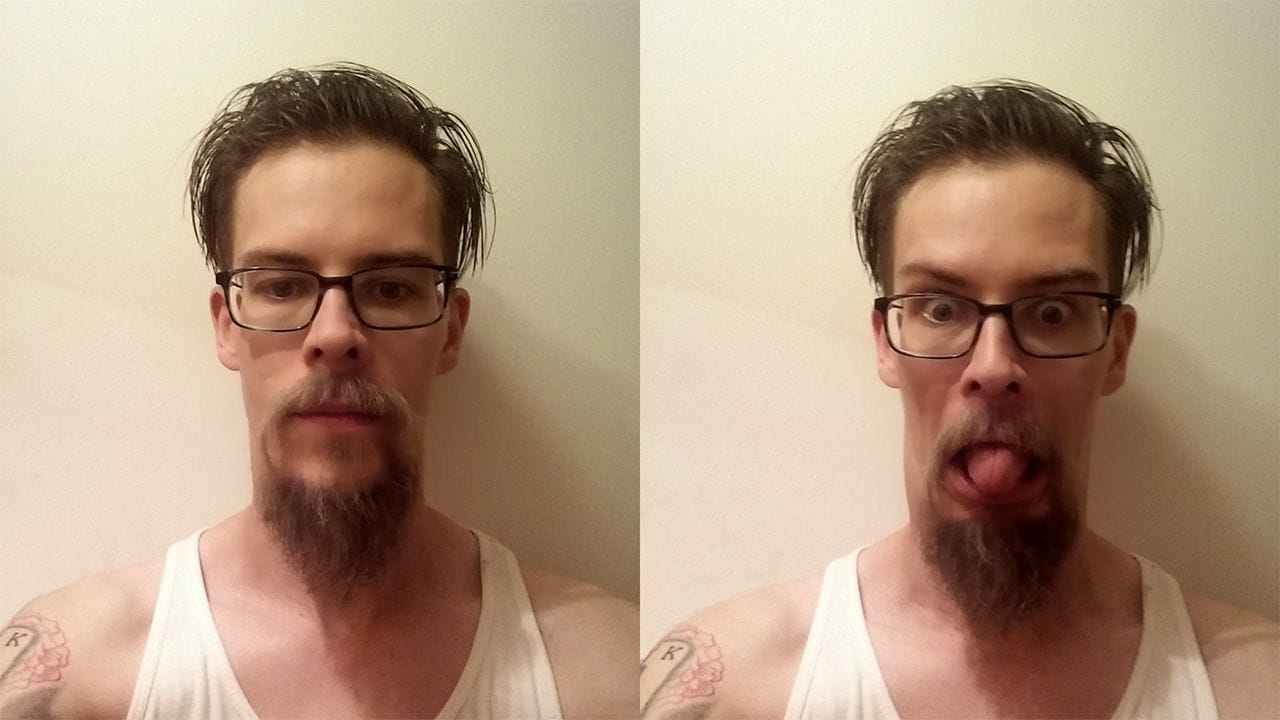 The beard growth after 47 weeks.